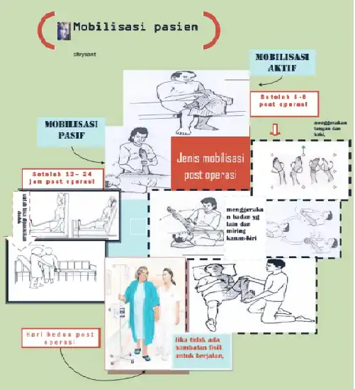 Gambar Konten EFISIENSI RUMAH SAKIT MELALUI MOBILISASI DINI